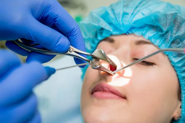 Endoscopic Sinus Surgery