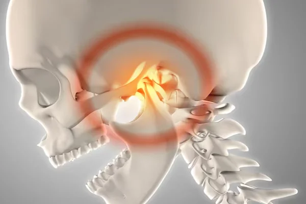 Nasal Bone Fracture Correction