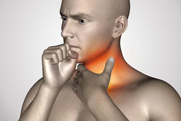 Throat Irritation