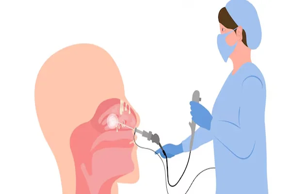 Diagnostic Nasal Endoscopy